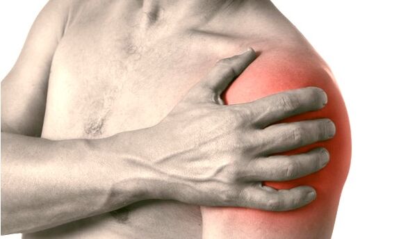 Opuchnuté, červené a zväčšené rameno - príznaky artrózy ramenného kĺbu 2. -3