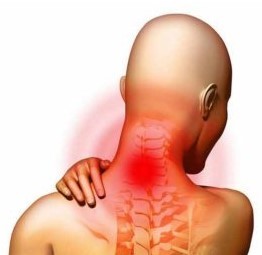 Osteochondrosis z krčnej chrbtice