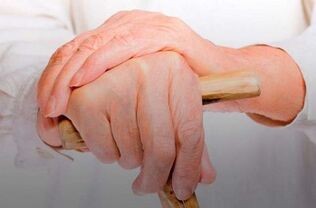 bolesť kĺbov prstov s reumatoidnou artritídou