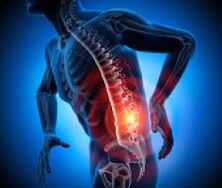 rôzne príčiny bolesti chrbta