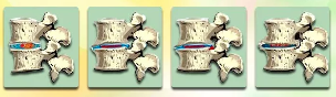 Etapy vývoja osteochondrosis