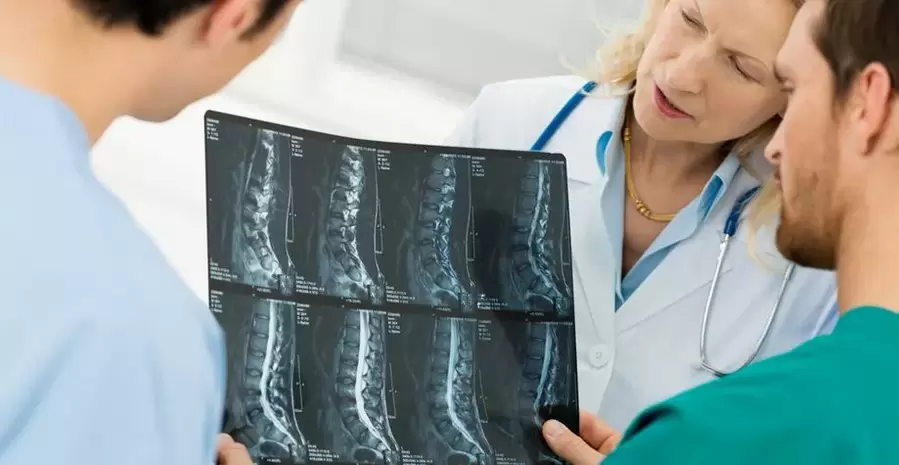 diagnostika osteochondrózy hrudnej oblasti