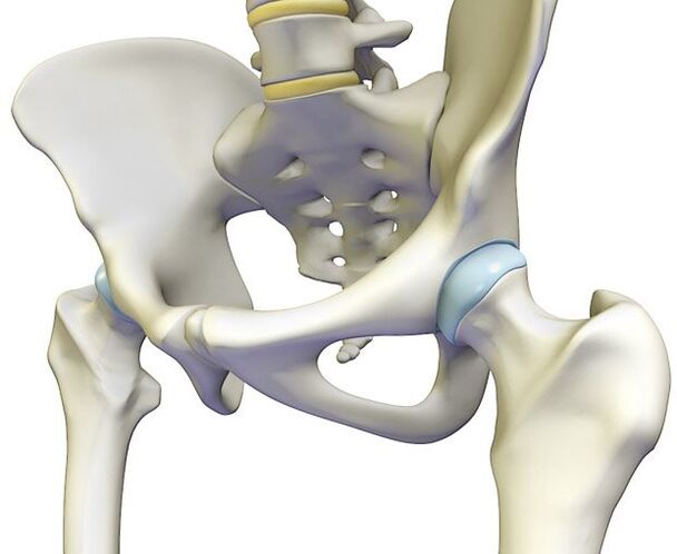 Osteochondróza vyvoláva ostrú bolesť v bedrovom kĺbe